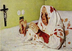 The supposed stigmatic Theresa Neumann, who seems to have used carbolic acid to generate her wounds, supplemented by her own menstrual blood, after sustaining head injuries and experiencing fits and visions