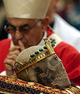 the crowned skull of St Wenceslas, apparently wearing a stocking, pehaps to stop his miraculously preserved teeth falling out